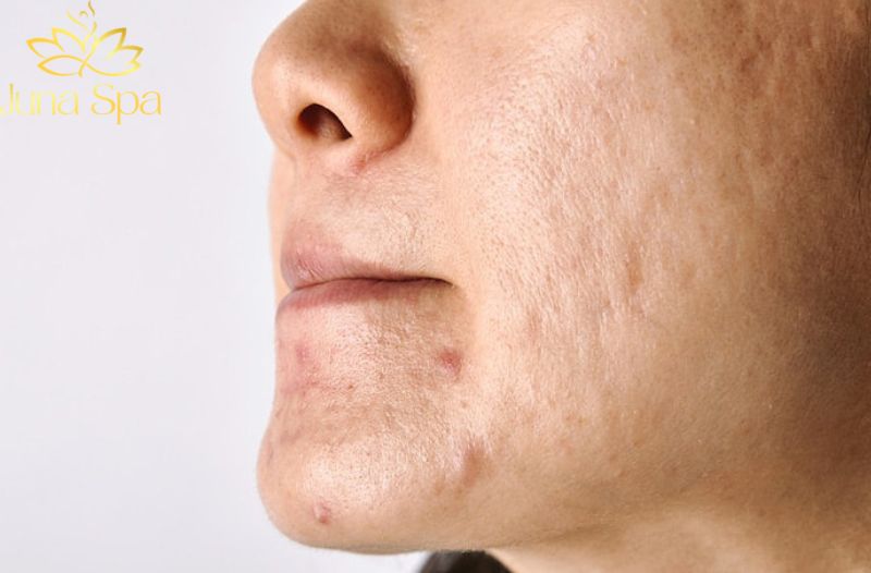 Tác động tích lũy từ môi trường và thói quen