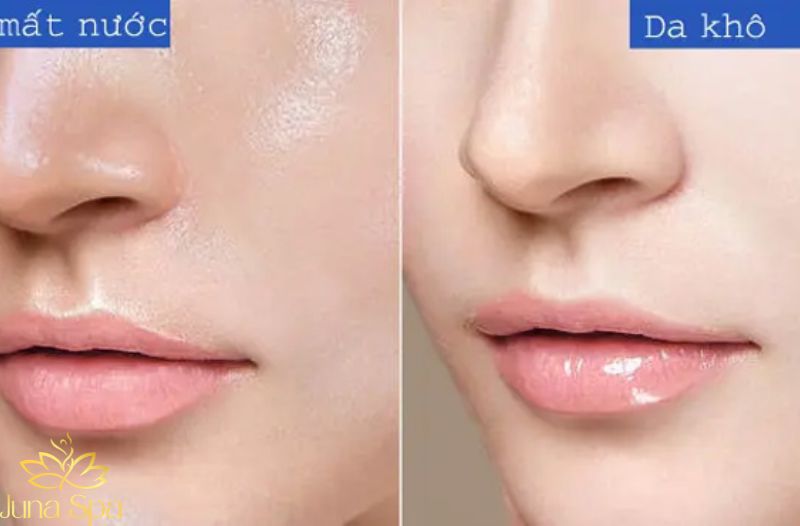 Những thói quen khiến tình trạng da trở nên khó kiểm soát