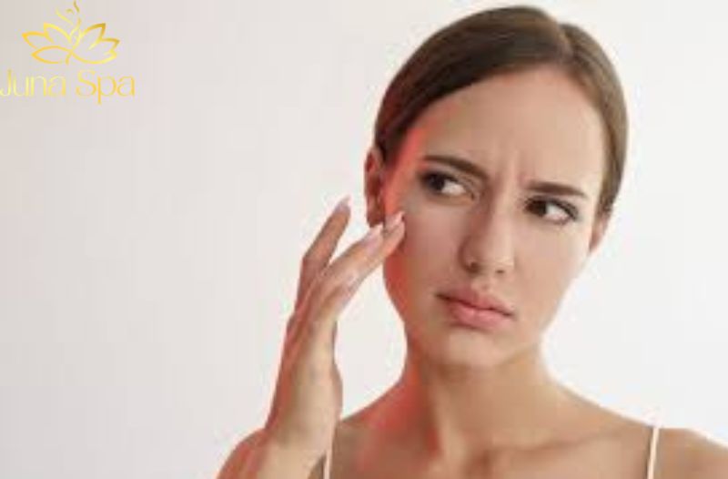 Cách chăm sóc da giúp hạn chế nám và tàn nhang trong mùa hè