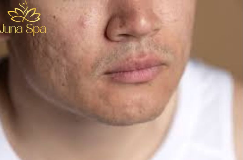 Tốc độ tái tạo da chậm lại theo thời gian