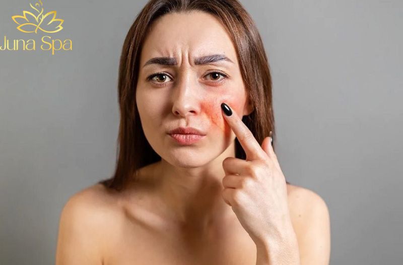 Vì sao không nên tự “phục hồi da” khi chưa hiểu rõ tình trạng?