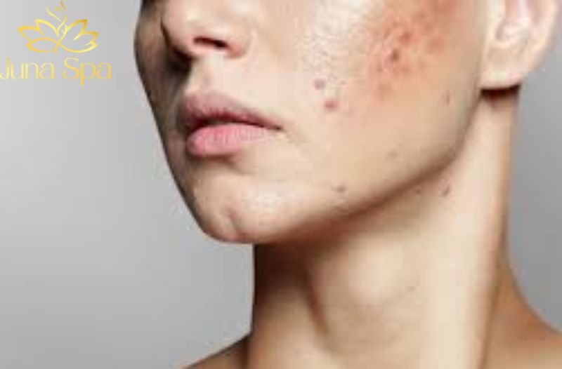 Vì sao chăm sóc tại nhà đôi khi chưa đủ