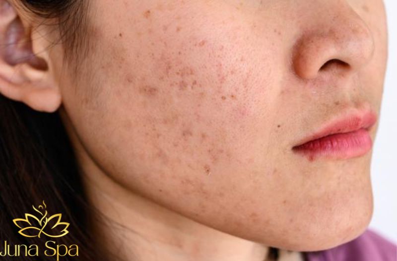 Sau tuổi 25, làn da thay đổi như thế nào
