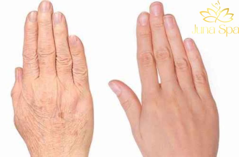 Cách chăm sóc da tay trong mùa nắng để hạn chế sạm màu 