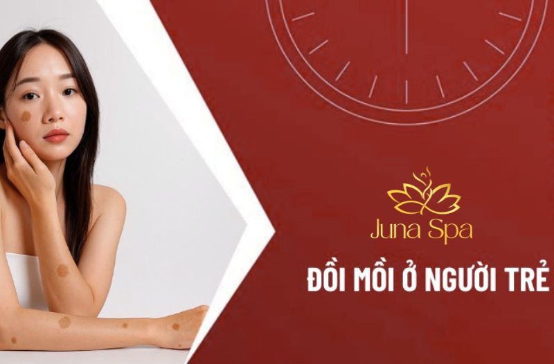 Đồi mồi ở người trẻ có cải thiện được không