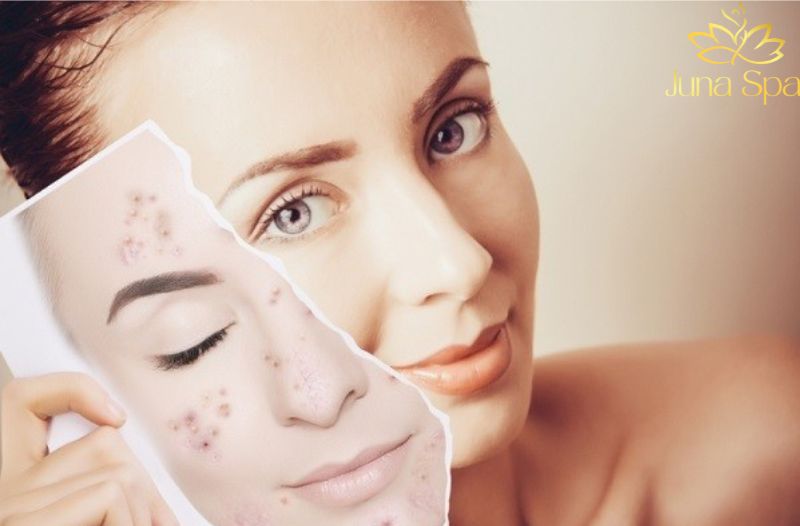 Thói quen sinh hoạt và nội tiết tố ảnh hưởng trực tiếp đến làn da