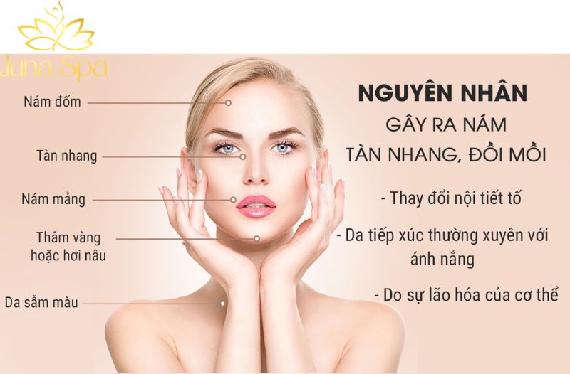 Nguyên nhân gây tàn nhang phổ biến