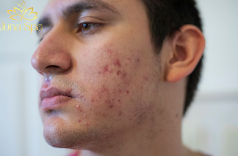Da được chăm sóc kỹ hơn thay vì tự xử lý tại nhà
